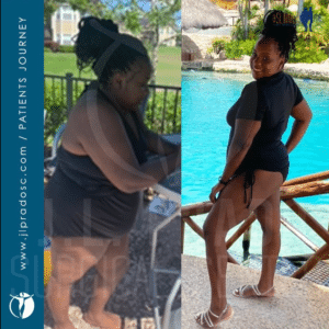 Before and after weight loss surgery transformations at JL Prado Surgical Center, showing patient journey to healthier lifestyle