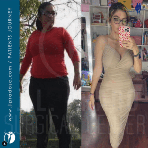 Visual evidence of weight loss success, with before and after surgery photos from JL Prado Surgical Center